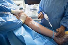What Should You Know About Vascular Surgery and Modern Treatment Options?